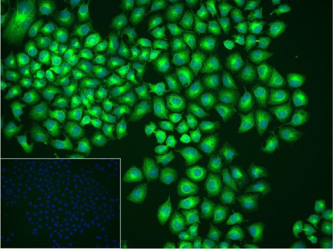 微管蛋白β1（内参）重组兔单抗