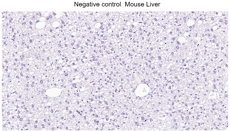 胶质纤维酸性蛋白重组兔单抗