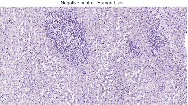 胶质纤维酸性蛋白重组兔单抗
