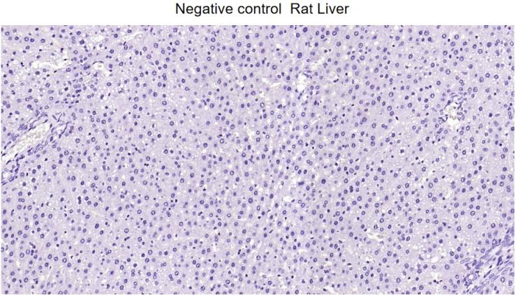 胶质纤维酸性蛋白重组兔单抗