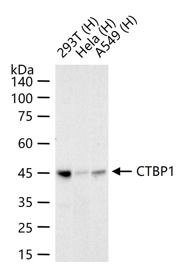 C端结合蛋白1重组兔单抗-bsm-61953R