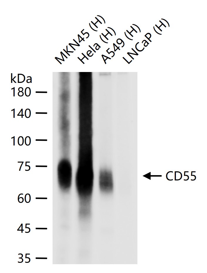 CD55 Recombinant Rabbit mAb (一抗) - WB,IHC-P,IHC-F,IF | Bioss