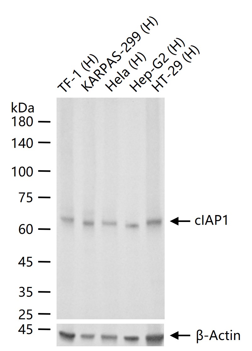 cIAP1 Recombinant Rabbit mAb (一抗) - WB,IHC-P,IHC-F,ICC/IF,IF | Bioss