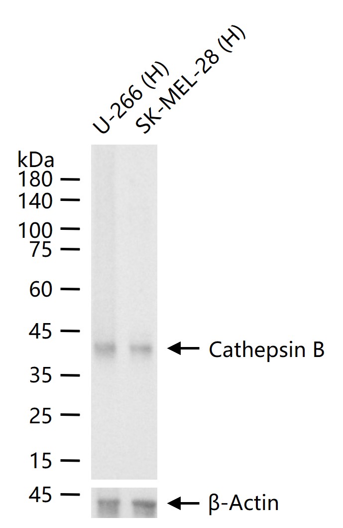 组织蛋白酶B重组兔单抗