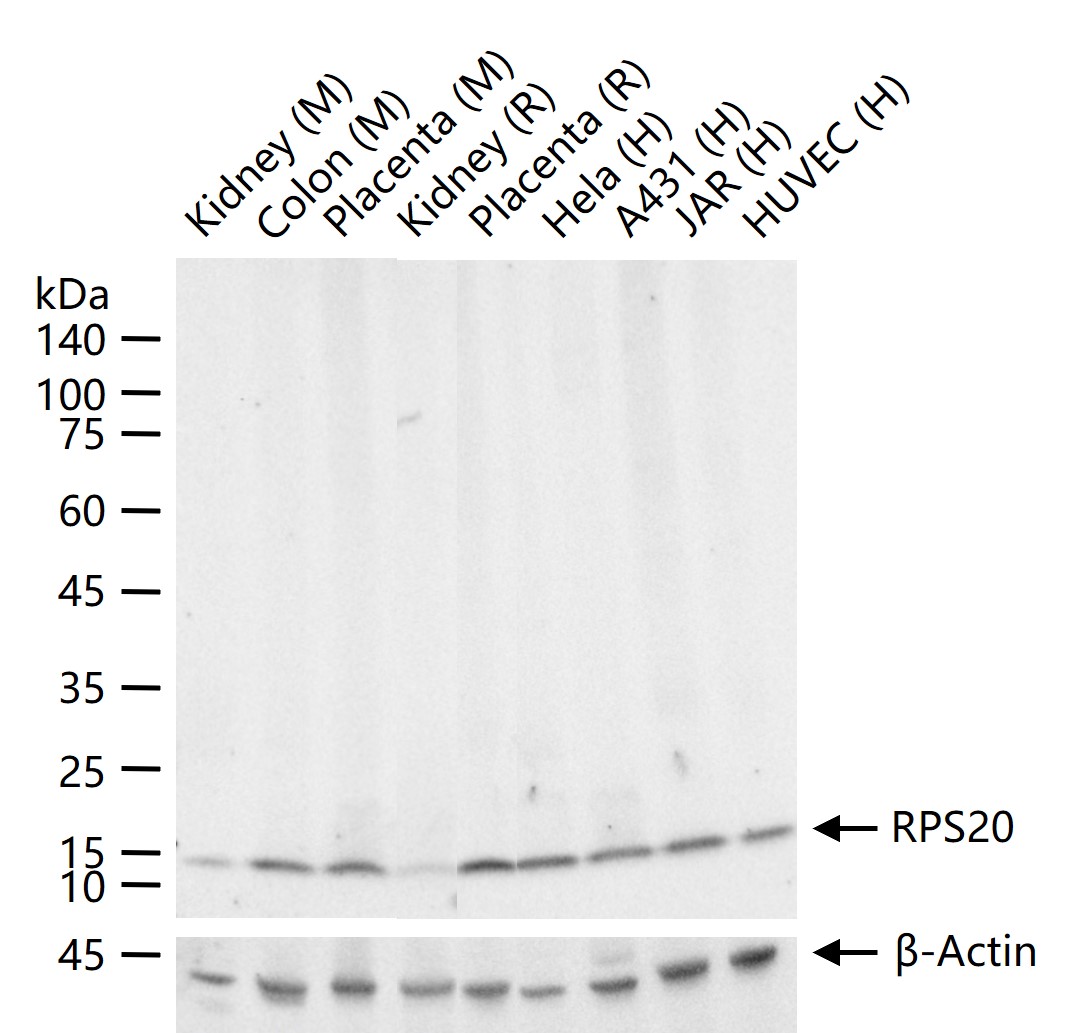 RPS20 Recombinant Rabbit mAb (一抗) - WB,IHC-P,IHC-F,IF | Bioss