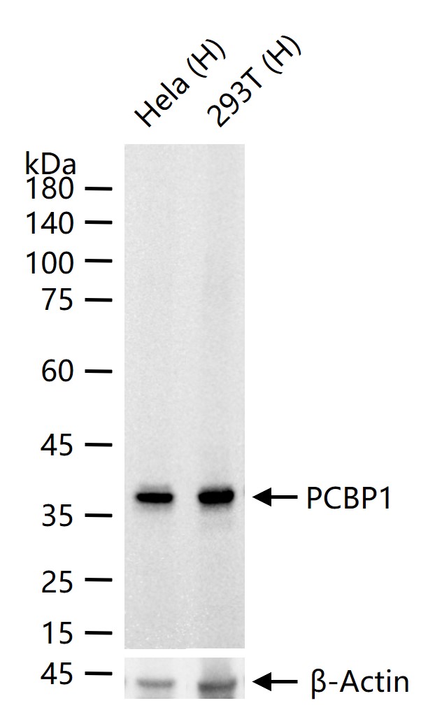 异构核糖核蛋白E1重组兔单抗
