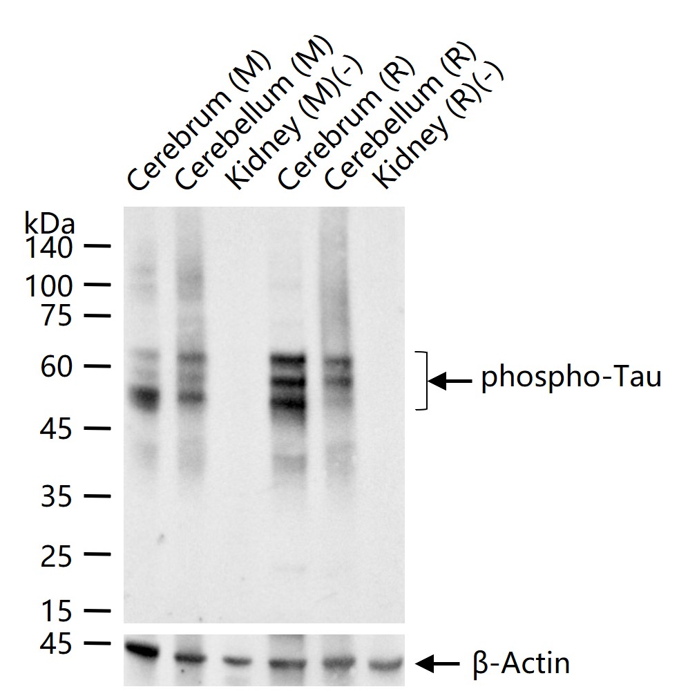磷酸化微管相关蛋白重组兔单抗