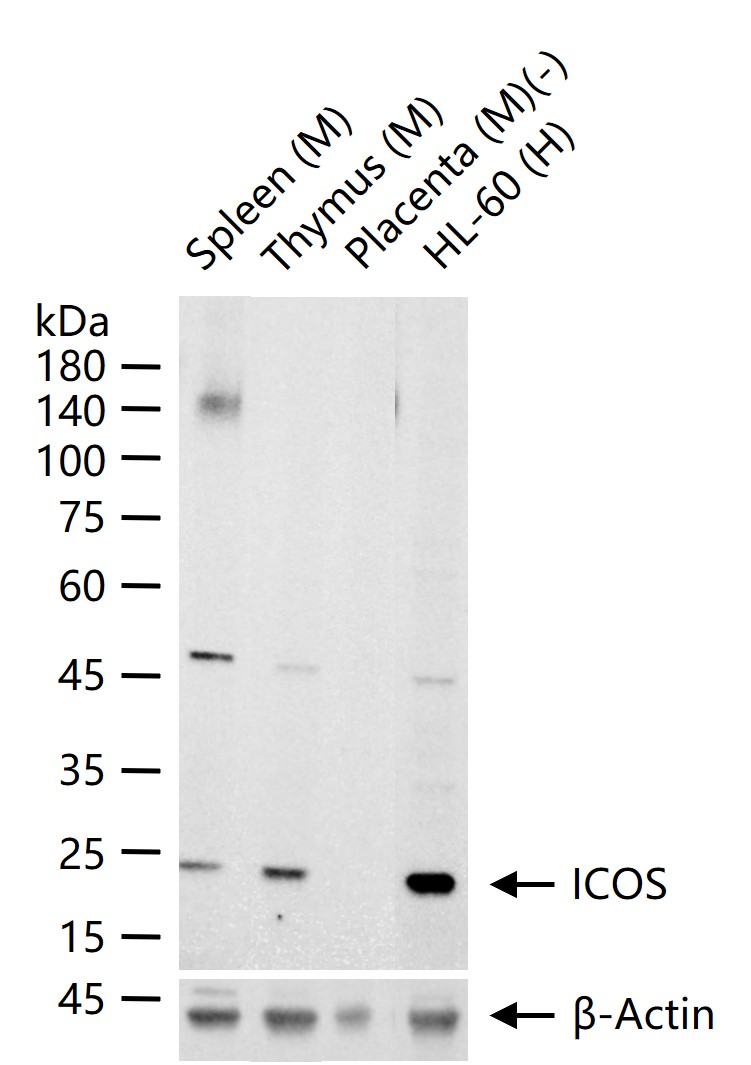 诱导协同刺激分子CD278重组兔单抗