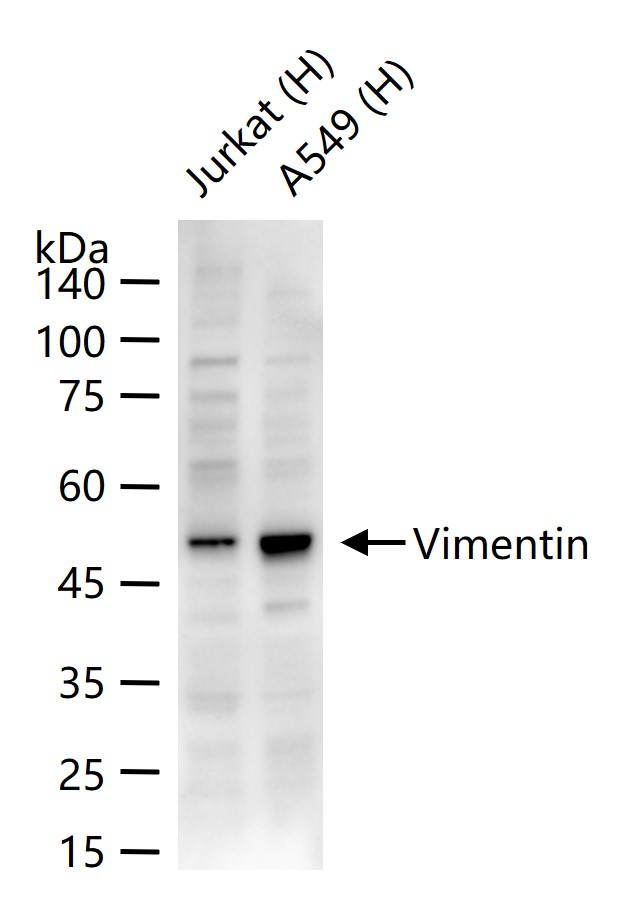 Streptavidin, HRP conjugated (标记蛋白质与多肽) | Bioss