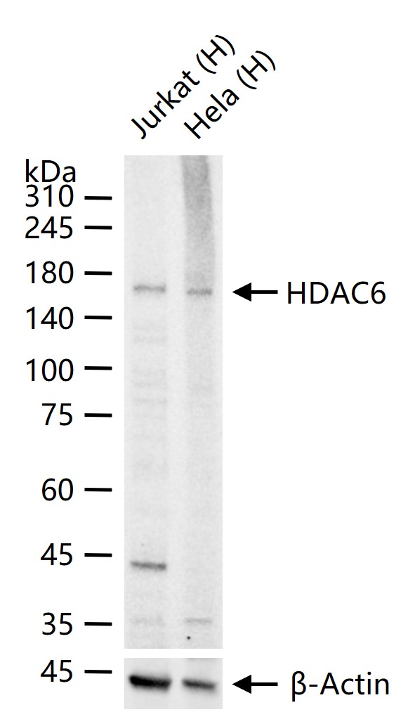 HDAC6 Recombinant Rabbit mAb (一抗) - WB,IHC-P,IHC-F,ICC/IF,IF | Bioss