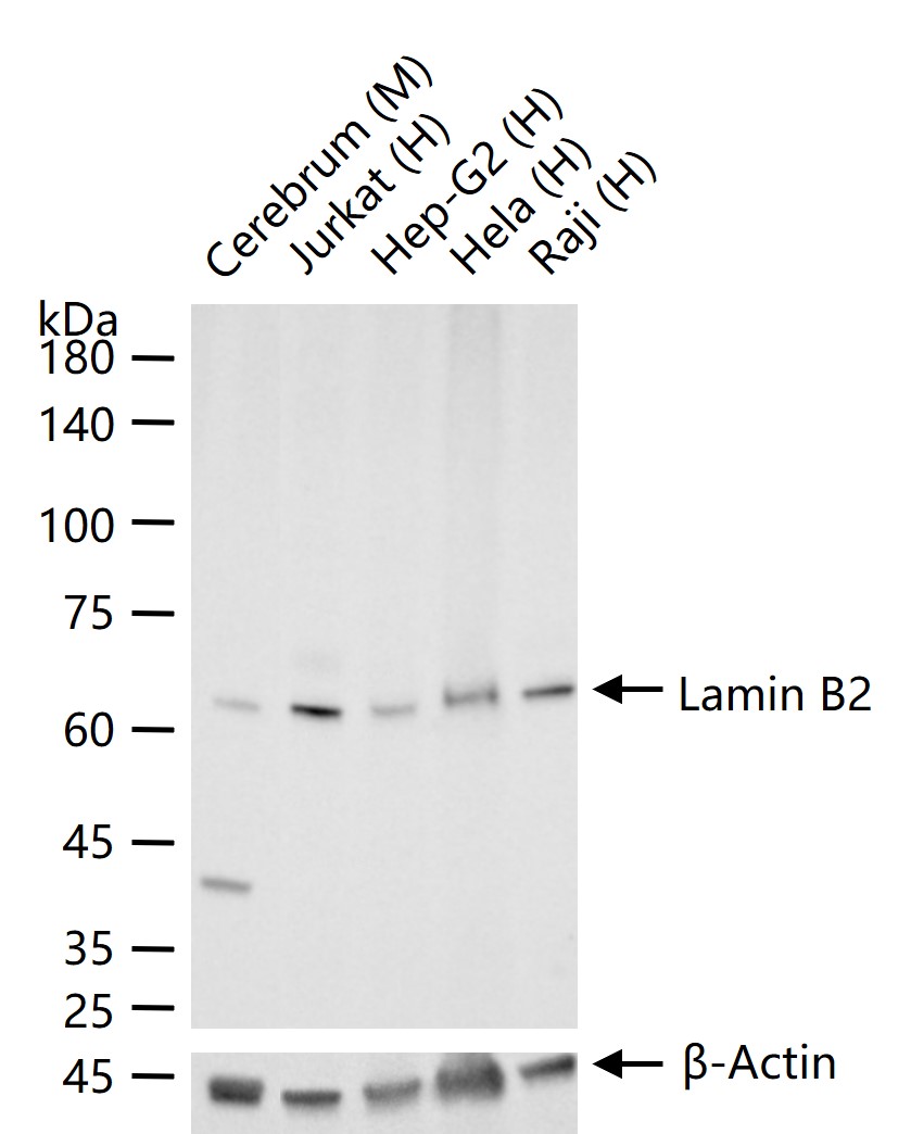 核纤层蛋白B2重组兔单抗