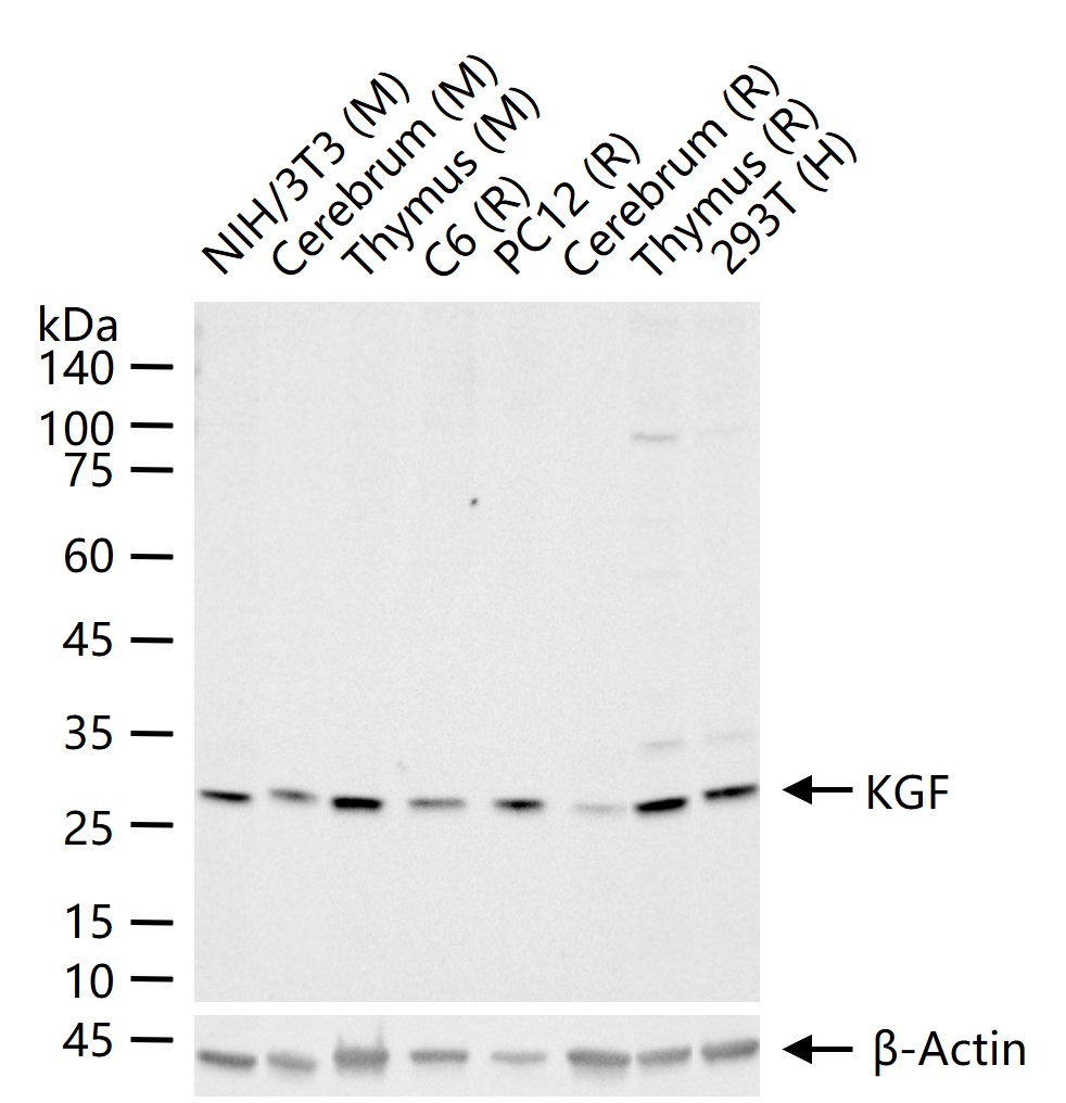 纤维母细胞生长因子7重组兔单抗