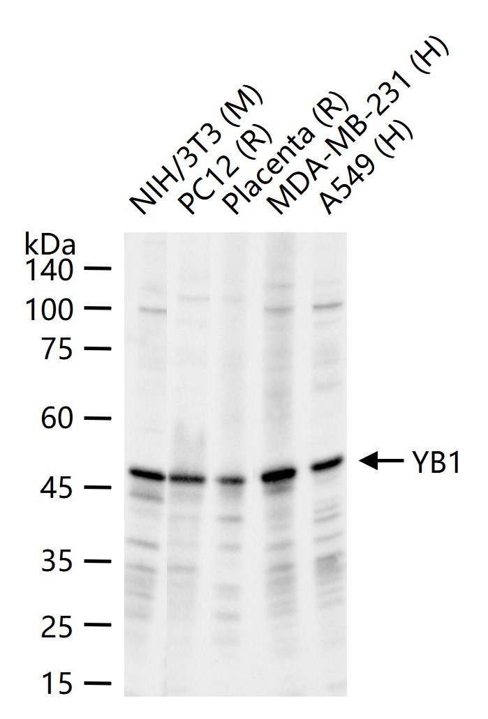 核酸酶敏感元件结合蛋白1重组兔单抗