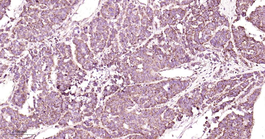 线粒体转录因子1重组兔单抗