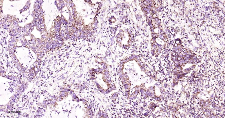线粒体转录因子1重组兔单抗