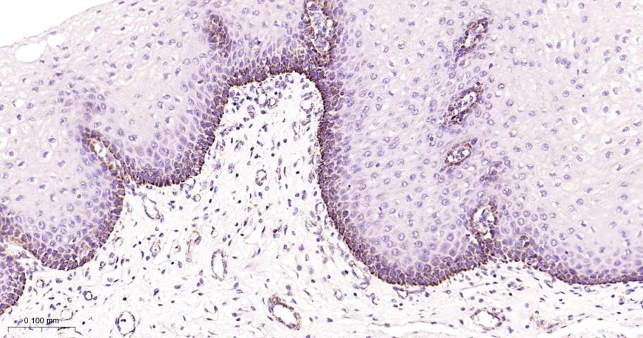 线粒体转录因子1重组兔单抗