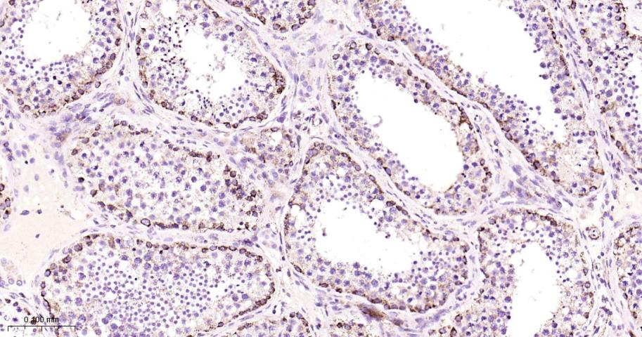线粒体转录因子1重组兔单抗