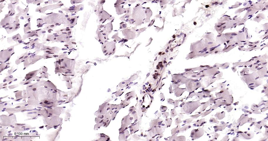 Emerin蛋白重组兔单抗-bsm-61601R