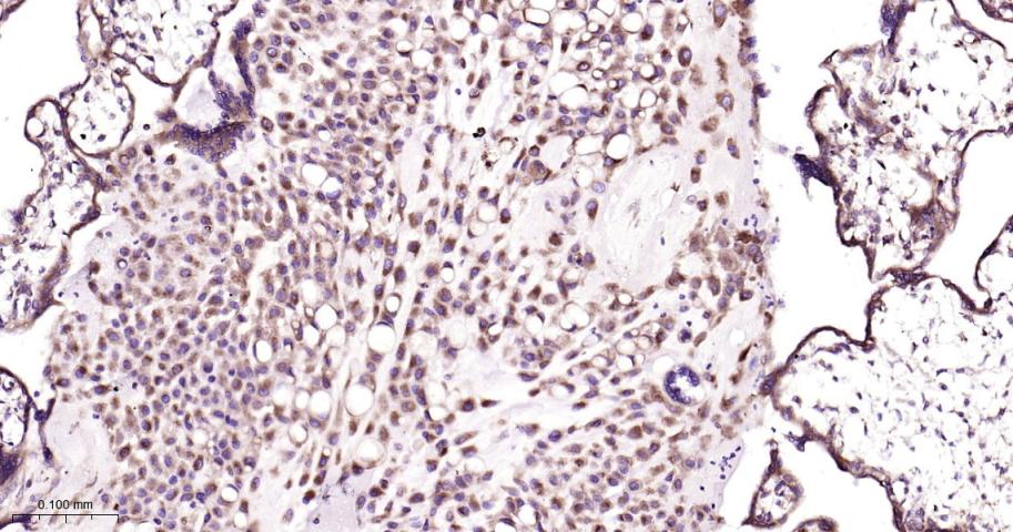 40S核糖体蛋白S20重组兔单抗-bsm-60503R