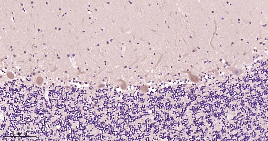 CARS1重组兔单抗-bsm-62444R