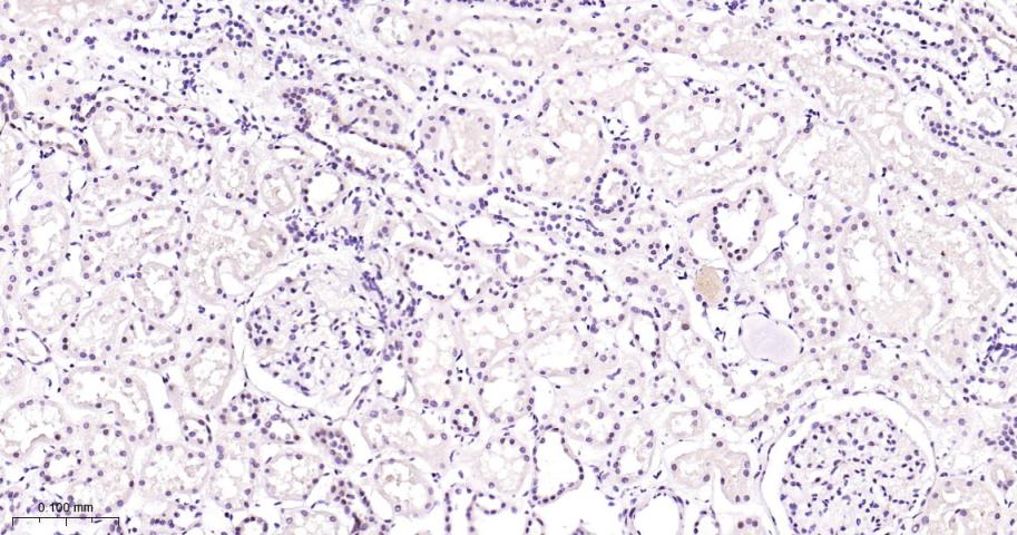 26S蛋白酶调节亚型S5a重组兔单抗-bsm-61859R