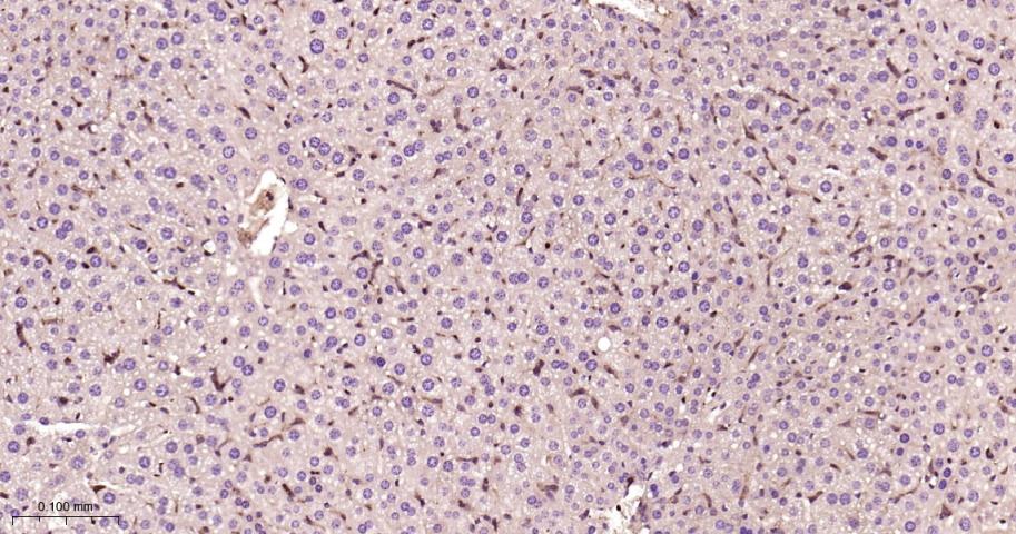 ras基因相关蛋白RAB5C重组兔单抗-bsm-62592R