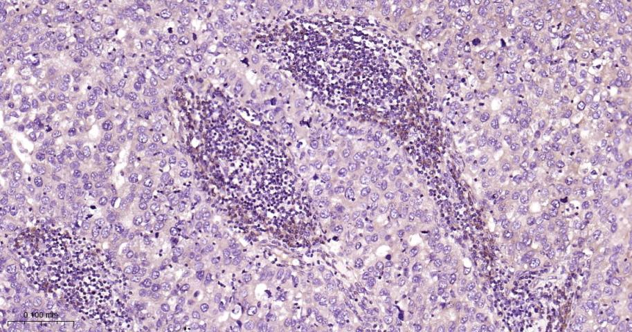 CARS1重组兔单抗-bsm-62444R