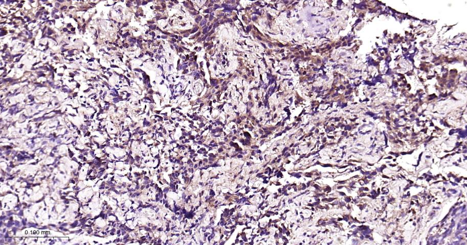 40S核糖体蛋白S20重组兔单抗-bsm-60503R