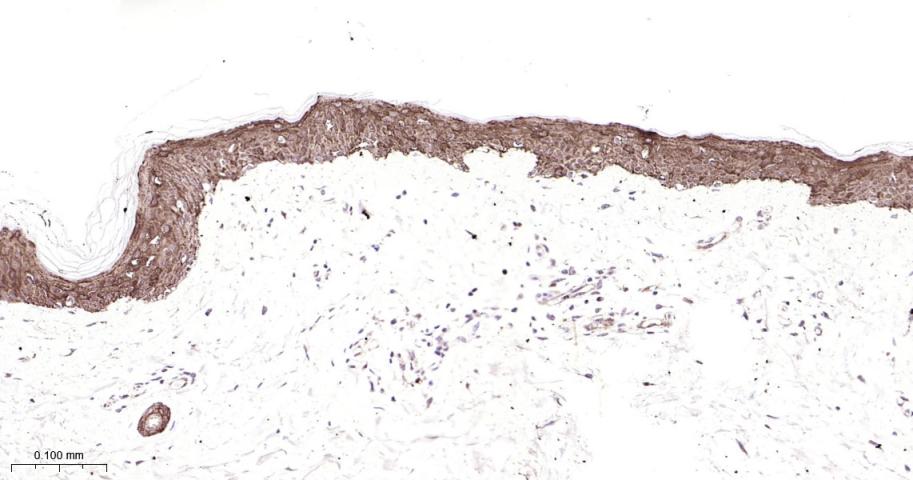 ras基因相关蛋白RAB5C重组兔单抗-bsm-62592R