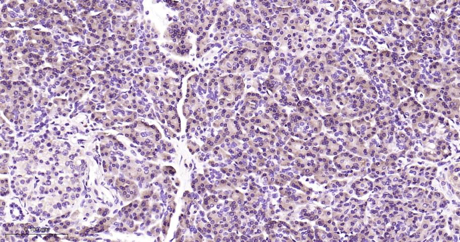 CARS1重组兔单抗-bsm-62444R