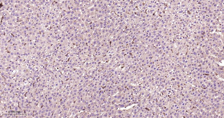 ras基因相关蛋白RAB5C重组兔单抗-bsm-62592R