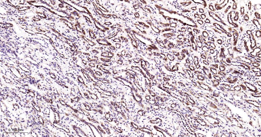 线粒体转录因子1重组兔单抗