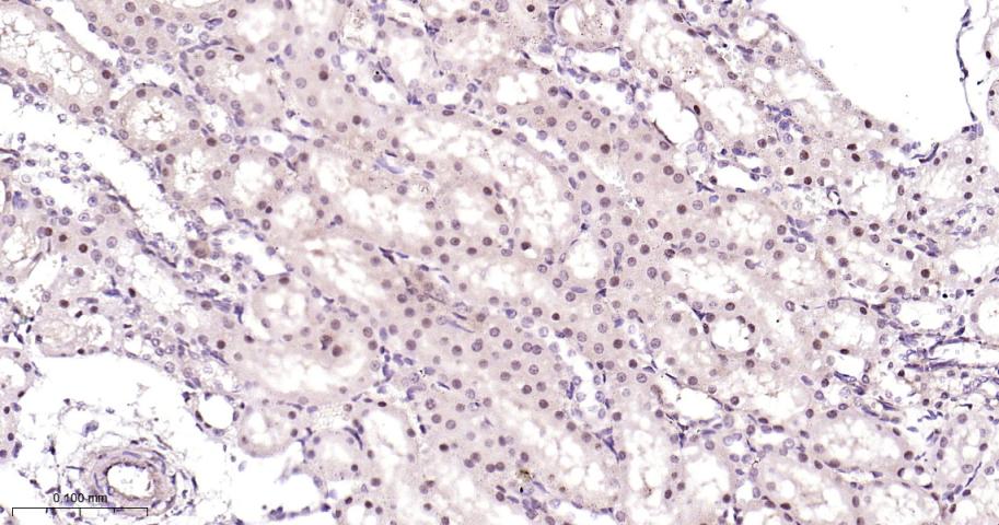 26S蛋白酶调节亚型S5a重组兔单抗-bsm-61859R