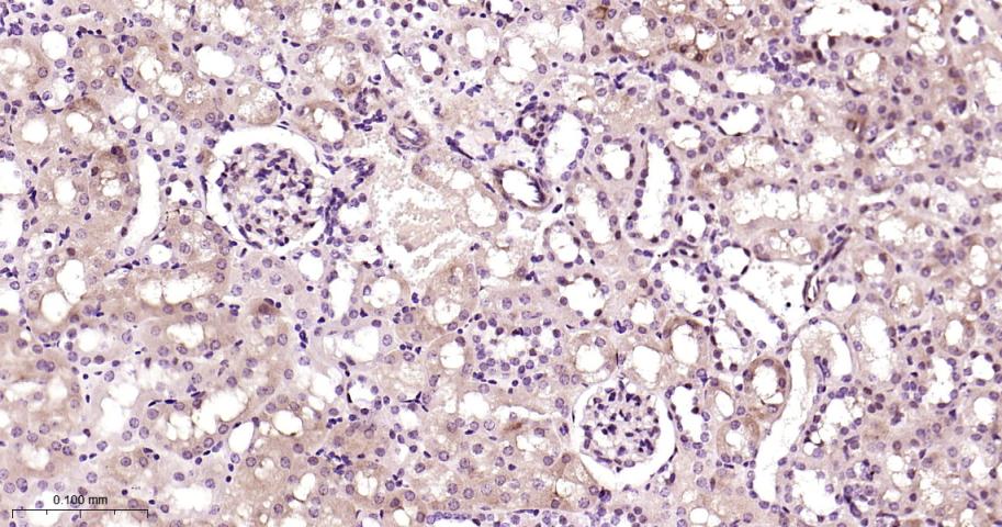 26S蛋白酶调节亚型S5a重组兔单抗-bsm-61859R