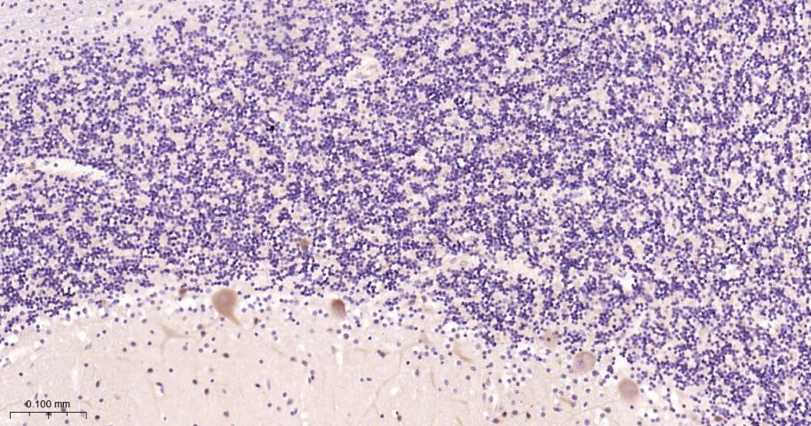 神经性舞蹈病蛋白重组兔单抗