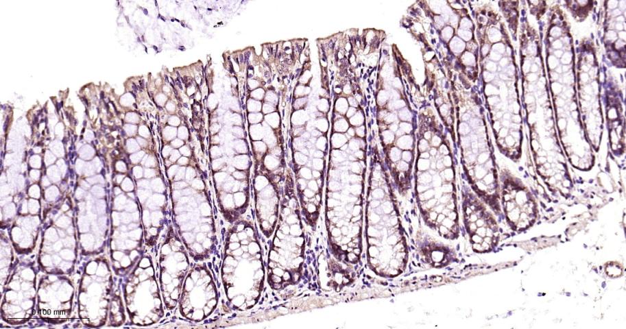 26S蛋白酶调节亚型S5a重组兔单抗-bsm-61859R
