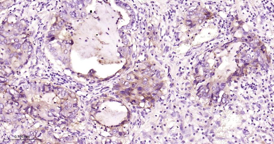 衰变加速因子CD55重组兔单抗-bsm-61587R