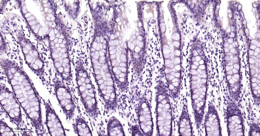 26S蛋白酶调节亚型S5a重组兔单抗-bsm-61859R