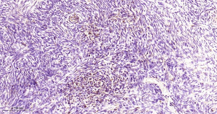 线粒体转录因子1重组兔单抗