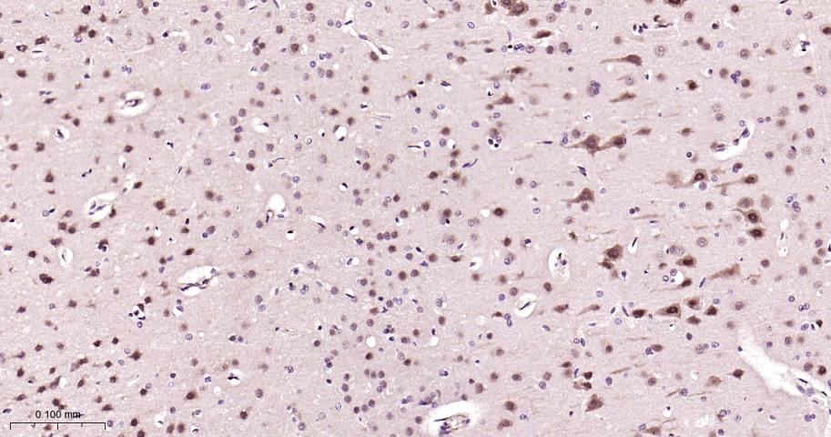 蛋白酶体PSMα2重组兔单抗-bsm-62091R