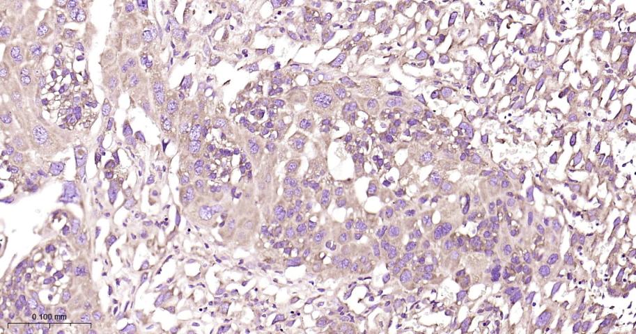 40S核糖体蛋白S20重组兔单抗-bsm-60503R