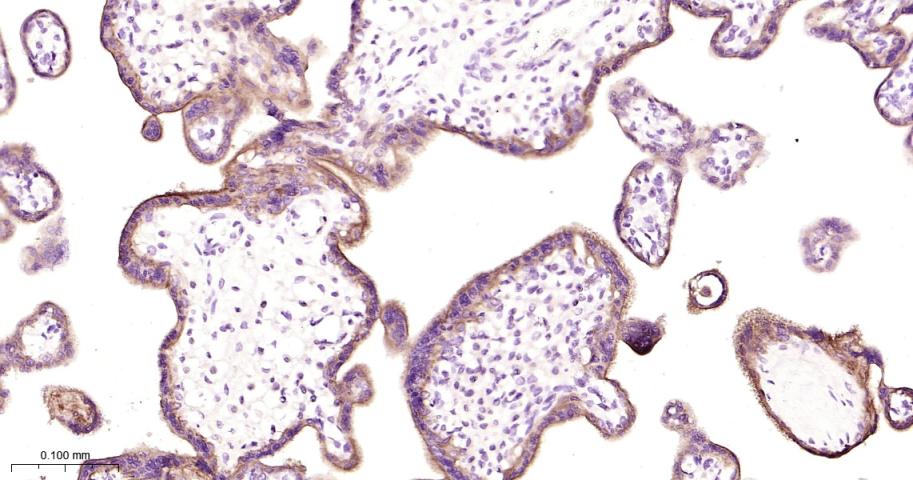 衰变加速因子CD55重组兔单抗-bsm-61587R