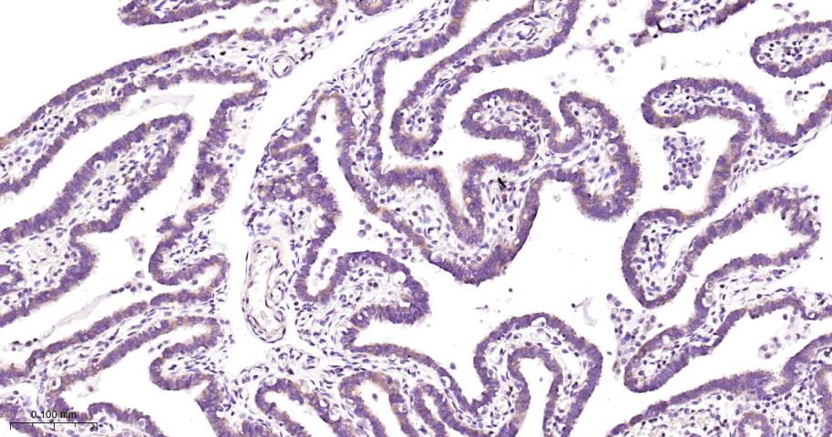 CARS1重组兔单抗-bsm-62444R