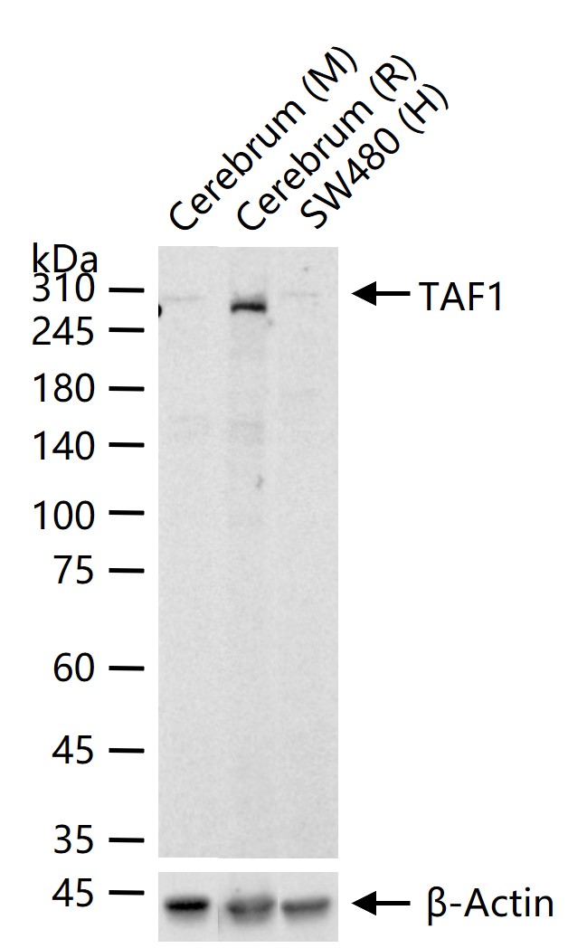 TAF1 Recombinant Rabbit mAb (一抗) - WB | Bioss