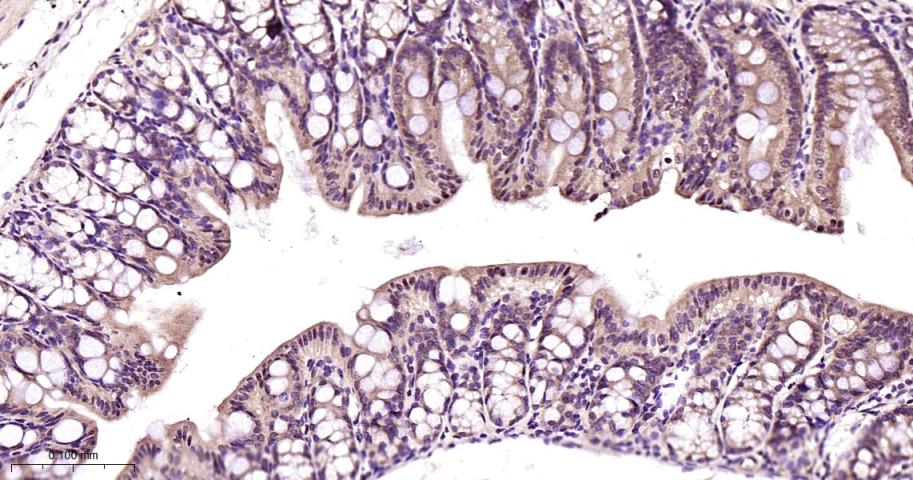 26S蛋白酶调节亚型S5a重组兔单抗-bsm-61859R