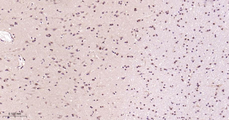 蛋白酶体PSMα2重组兔单抗-bsm-62091R