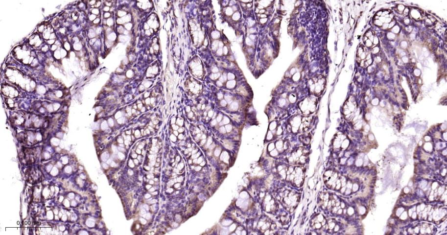 40S核糖体蛋白S20重组兔单抗-bsm-60503R