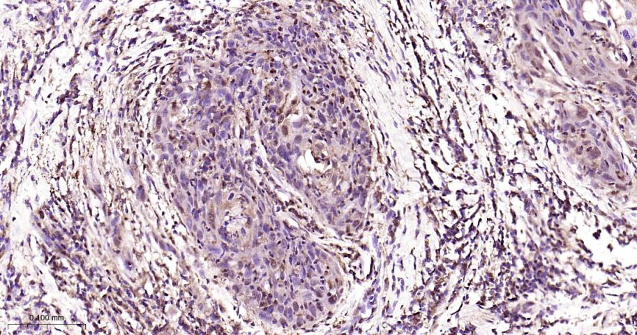蛋白酶体PSMα2重组兔单抗-bsm-62091R