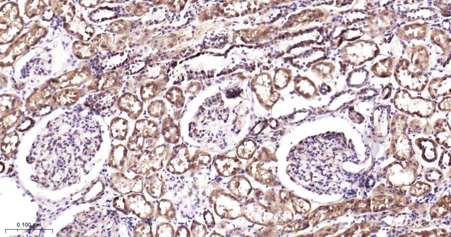 细胞色素c氧化酶IV重组兔单抗
