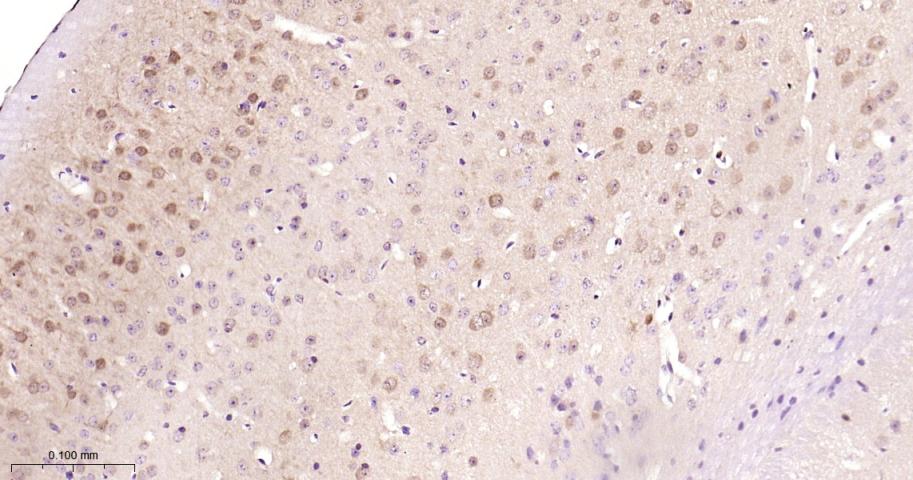热休克蛋白-70重组兔单抗